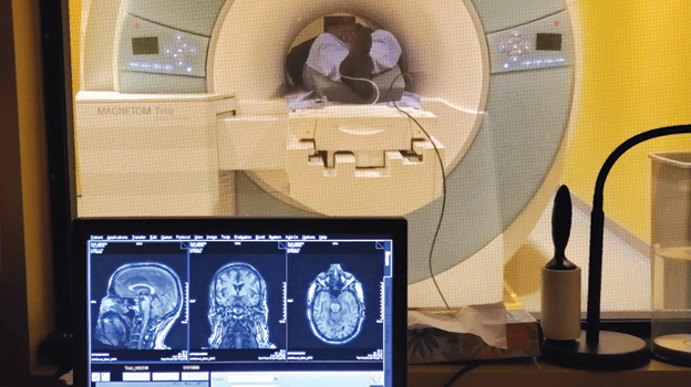 العلاج الصوتي غير الجراحي يعزز الآمال في علاج ألزهايمر 