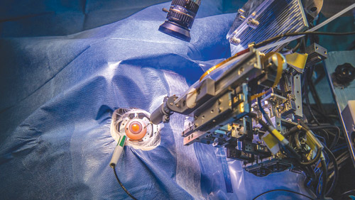 الصين تطوّر روبوتًا لجراحة العين 