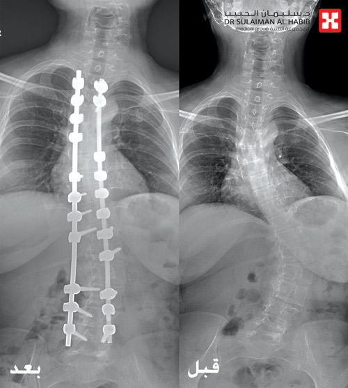 سبب لها العديد من الآلام والمضاعفات 