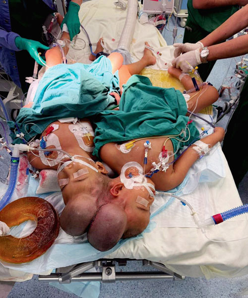 إنفاذاً لتوجيهات خادم الحرمين وولي العهد 