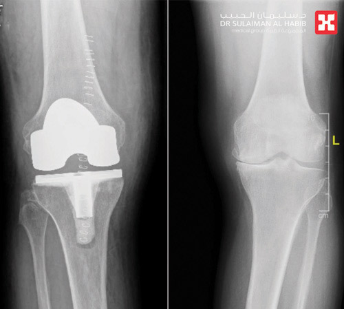 بعد معاناة استمرت لسنوات 